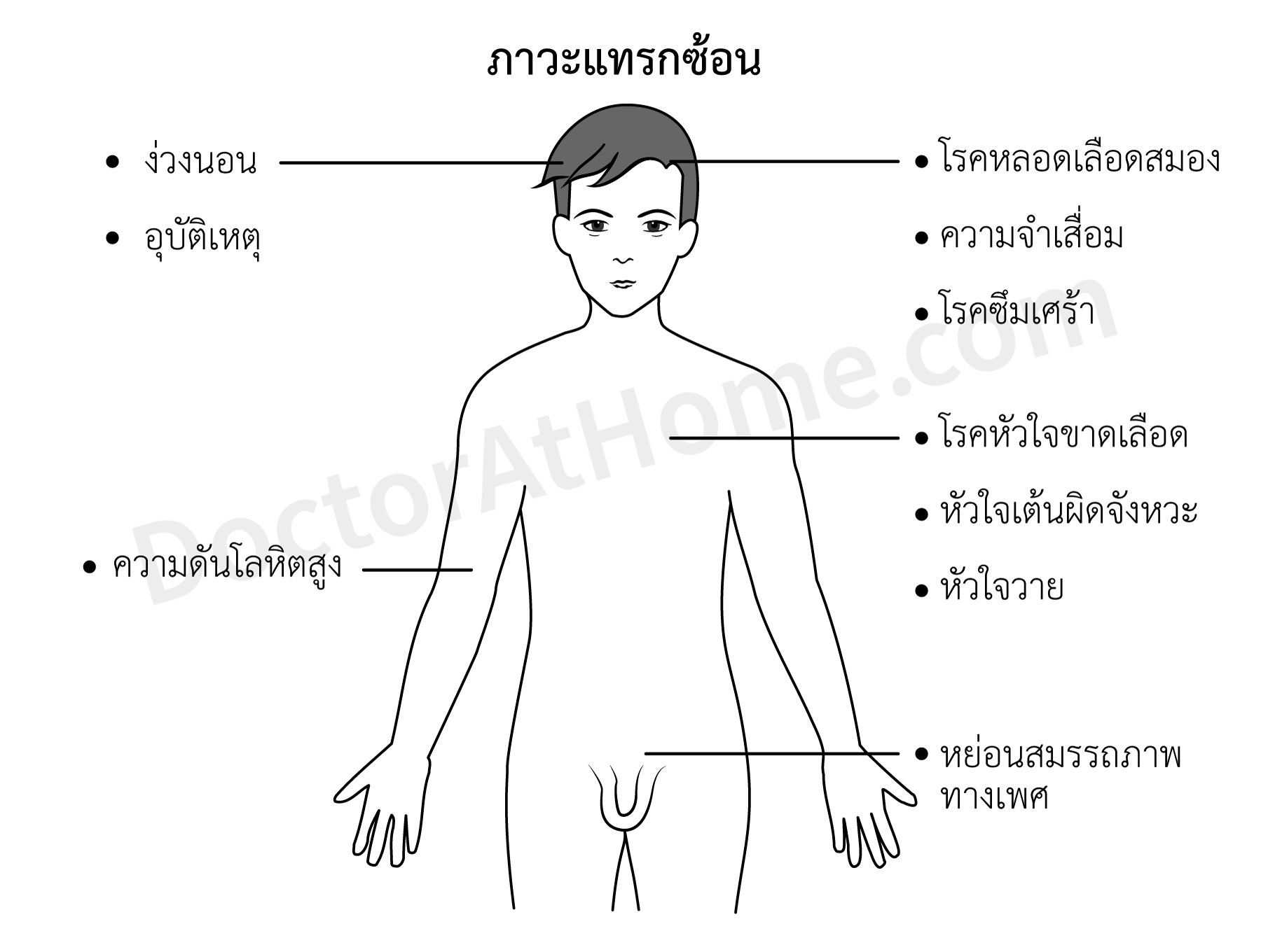 ภาวะหยุดหายใจขณะหลับ